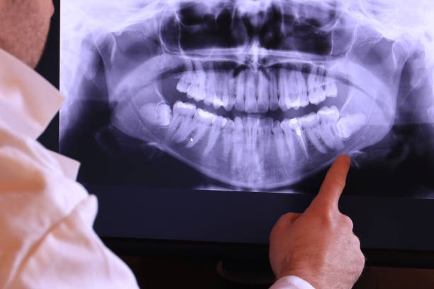 Best Emergency Care for Gum Disease in Bastrop, TX