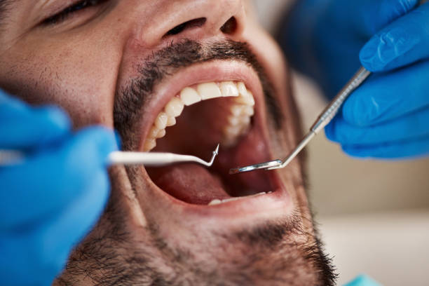Best Broken or Chipped Tooth Repair in Bastrop, TX